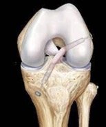 figure of screw-less acl