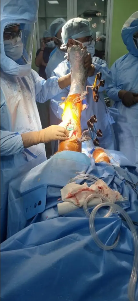 3D Knee Scan for Surgery